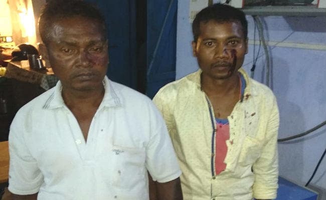 गुमला : रसोई-गैस बांटने गये गैस एजेंसी के दो कर्मियों पर फायरिंग, गोली का छर्रा लगा