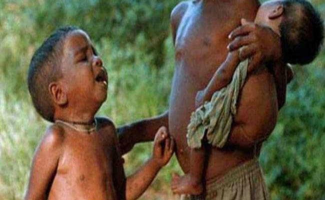 बौनेपन की गोद में बिहार का बचपन, 48% बच्चे बौनेपन की चपेट में, पूर्वी चंपारण में सबसे अधिक समस्या