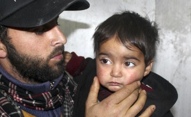 जम्‍मू-कश्‍मीर : पैलेट की शिकार 18 माह की हिबा के आंख की हुई सर्जरी, रोशनी लौटेगी या नहीं, डॉक्‍टर्स को नहीं पता