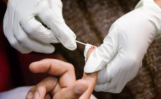 एचआइवी के लक्षण हैं तो घबराएं नहीं पूरी जांच कराएं, जानें एचआइवी संक्रमण के प्रमुख कारण