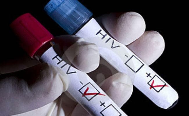 सीवान में एक साल में बढ़ गये एड्स के 314 नये मरीज, 40 मरीजों ने इलाज के दौरान दम तोड़ा