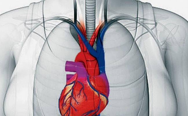 पटना : दिल में छेद है तो डरें नहीं, आईजीआईएमएस में फ्री इलाज