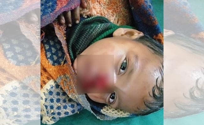 टाटीझरिया : आवारा कुत्तों का आतंक, छोटे बच्चे को बुरी तरह काटा, स्थिति गंभीर