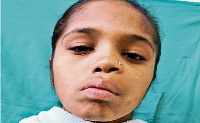 पटना : बायें जबड़े की ओर था ट्यूमर मुफ्त में आयुष्मान योजना के तहत की गयी सर्जरी