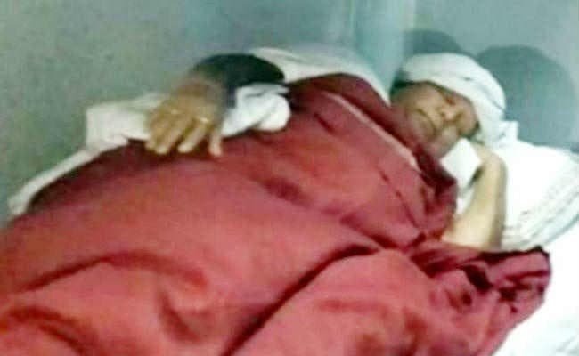 अचानक दोबारा बिगड़ी लालू प्रसाद यादव की तबीयत