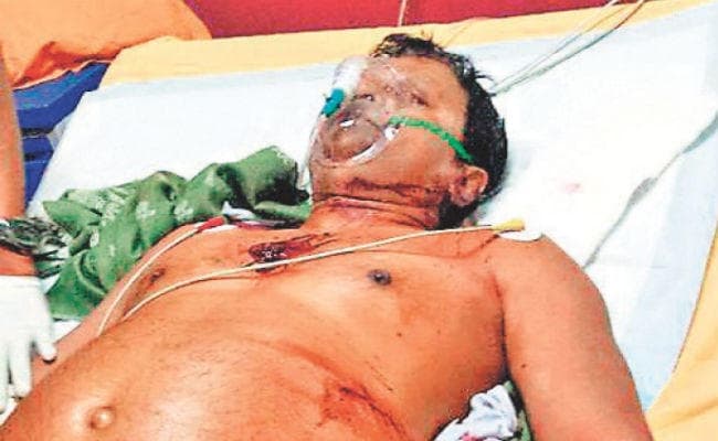 मकान मालिक दंपती पर किरायेदार ने चलाया चाकू