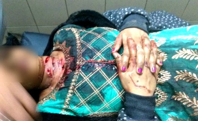 महिला की गर्दन पर वार कर पति को किया अगवा, प्रेम विवाह कर पटना में रहती थी महिला