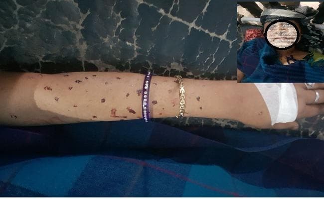 इस युवती के शरीर के कई हिस्सों से जब अचानक निकलने लगा खून, उसके बाद...