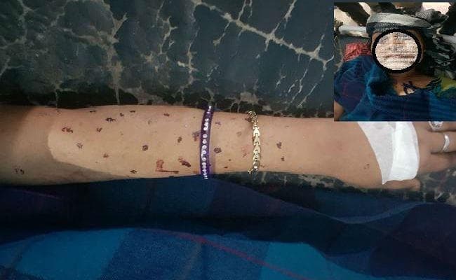 मायूस हो घर लौटी गीता, मंत्री के निर्देश पर पटना में कराया गया था भर्ती, डॉक्टरों ने इलाज करने से किया इनकार