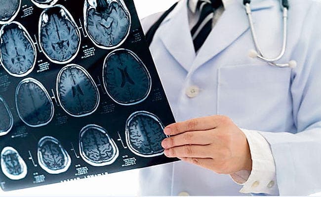 इन कारणों से बढ़ता है ब्रेन स्ट्रोक का खतरा, इलाज के लिए केवल 3 घंटे का समय होता है