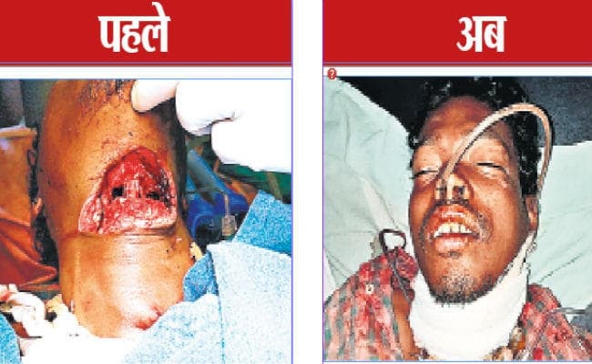 बेटे ने मां को चाकू से काट कर मारा, अपना भी गला रेता, हड़ताल पर थे डॉक्टर फिर भी बचायी जान