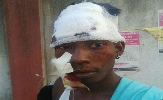 मवेशी को बचाने के चक्कर में बाइक की टक्कर, एक व्यक्ति की मौत