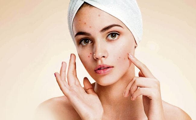 जानें एलर्जी के प्रमुख लक्षण अैर उपचार के बारे में