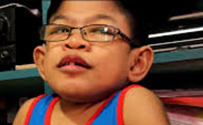 OMG! : सिर्फ लड़कों को होती है यह बीमारी, एक खुराक दवा की कीमत है 10 लाख रुपये