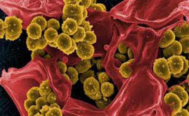 सर्जरी के दौरान संक्रमण को रोकने में कारगर हो सकता है ग्रेफाइन फ्लेक्स : अध्ययन