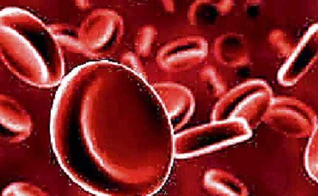 हिमोग्लोबिनोपैथी की रोकथाम अब झारखंड में होगी, प्रभावितों को आपस में विवाह नहीं करने की सलाह