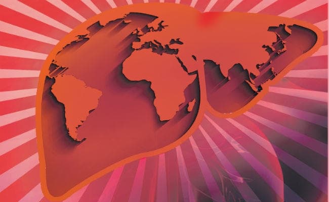 19 अप्रैल वर्ल्ड लिवर डे, अनदेखी ठीक नहीं