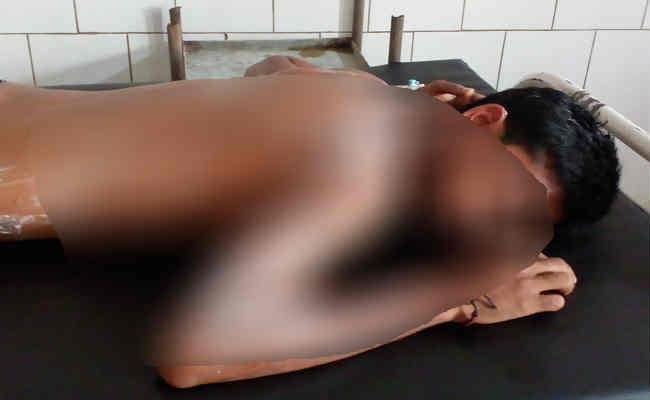 बिहार : सहरसा में क्रिकेट खेलने जा रहे तीन युवकों पर उड़ेला तेजाब, एक की हालत गंभीर