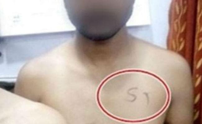 सीने पर एससी-एसटी लिखने का मामला गरमाया, मानवाधिकार आयोग ने शिवराज सरकार को भेजा नोटिस