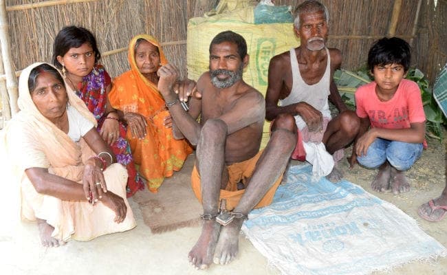 इलाज के अभाव में जंजीरों में मानवता, 10 साल से बेड़ियों में रामबाबू