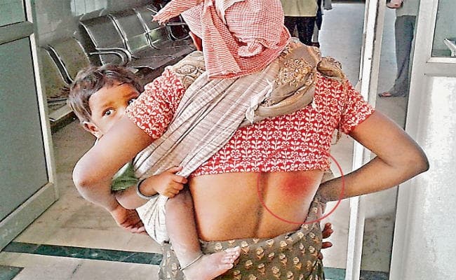 गुमला : खेत में शौच करने गयी थी आदिवासी महिला, खेत मालिक ने महिला के हाथ से फेंकवाया मैला