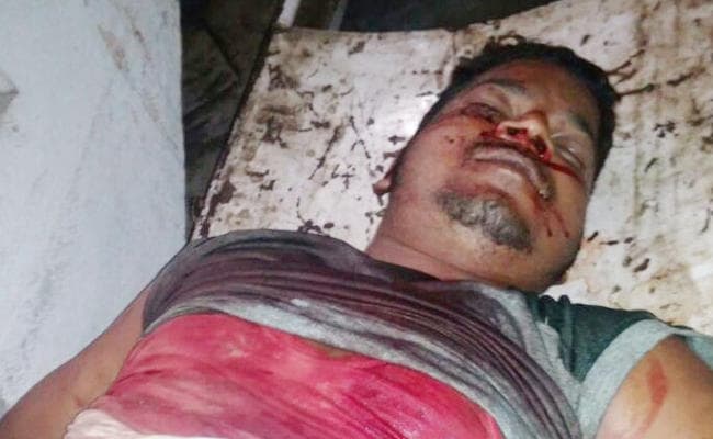 धनबाद में दिन-दहाड़े युवक की गोली मारकर हत्या