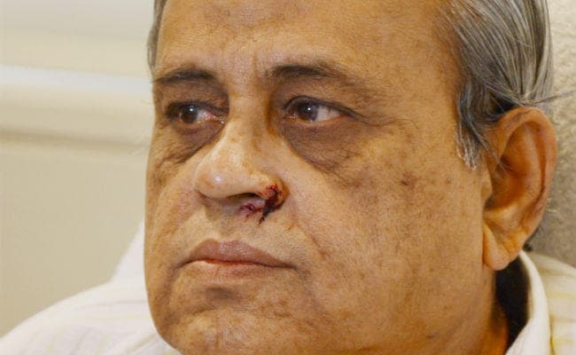 बिहार म्यूजियम के डिप्टी डायरेक्टर ने सीनियर का पकड़ा कॉलर, किया लहूलुहान, जांच के बाद हटाये गये, ...पढ़ें क्या है पूरा मामला