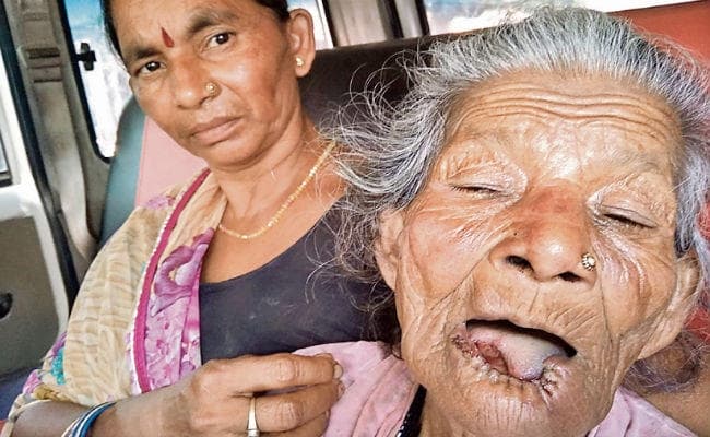 गोपालगंज : ....जब चोरी करने से मना करने पर वृद्धा की जुबान-होंठ को काटा