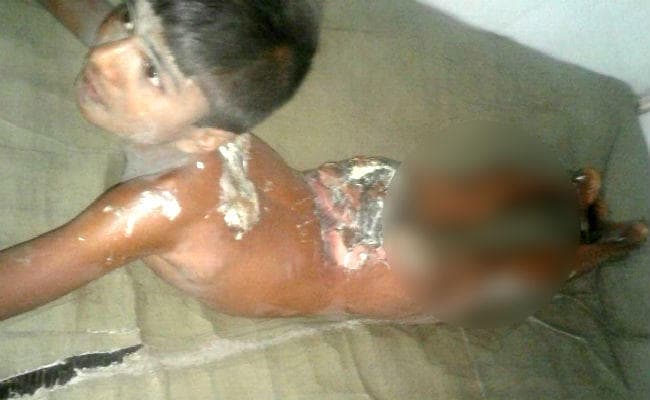 गया : ट्रांसफार्मर पर हाईटेंशन तार गिरने से हुआ विस्फोट, एक ही परिवार के सात लोग झुलसे