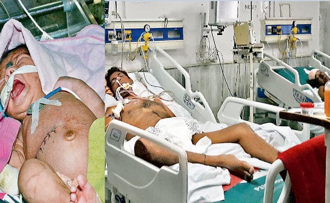 रिम्स में 40 घंटे की हड़ताल ने ली 25 जानें, मासूम के दर्द से बेपरवाह नर्सें अपनी इन शर्तों पर ही मानीं