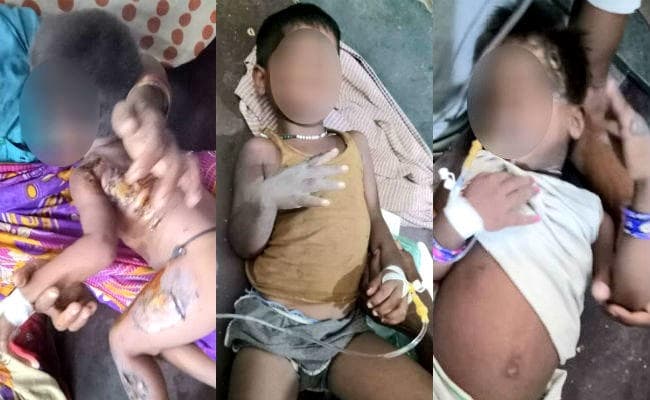बिजली के तार की चपेट में आने से आधा दर्जन से ज्यादा लोग झुलसे, लाखों की संपत्ति हुई खाक