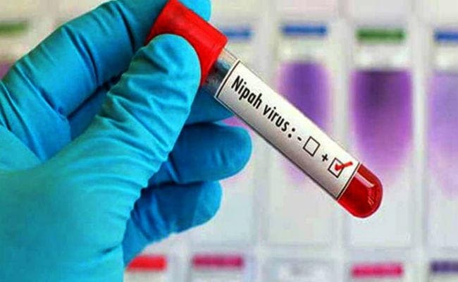 बागडोगरा में सूअरों की मौत से ‘निपाह’ का आतंक