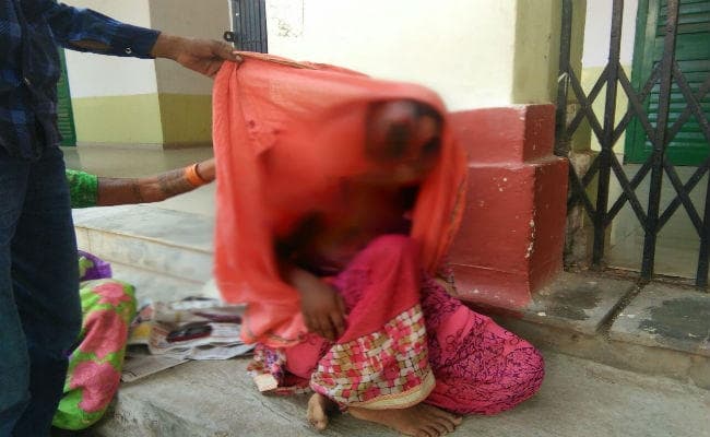 Shocking : बेटा नहीं जना, तो पति ने तेजाब से नहलाया , केस दर्ज