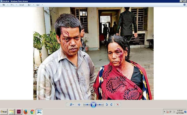 नाली से पानी की निकासी को ले मारपीट, मां-बेटा घायल