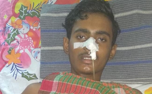 बाप रे! आदमी के पेट में इतना बड़ा पत्थर!