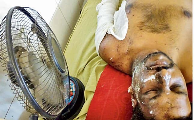 विस्फोट के बाद आठ फीट की दीवार को फांद कर राजा ने बचायी जान