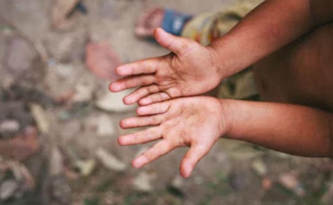 भूख से बिलबिला रहा था पूरा परिवार, 10 दिनों से नहीं मिला था खाना, जानिए क्यों महिला और उसके 5 बच्चों की हो गई ऐसी हालत