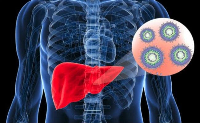 Health News: हेपेटाइटिस को हल्के में न लें, हर साल 4 लाख लोगों को निगल रहा यह संक्रमण