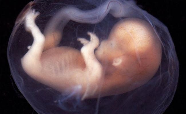 Air Asia फ्लाइट के बाद अब दिल्ली के इस अस्पताल के टॉयलेट में मिला भ्रूण