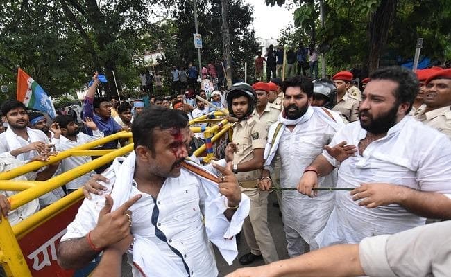 मुजफ्फरपुर दुष्कर्म कांड : NSUI का पटना में प्रदर्शन, पुलिस की लाठी से फटा कांग्रेस MLA का सिर