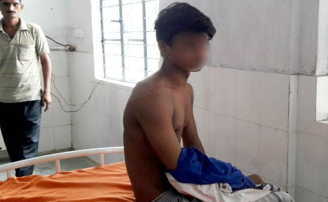 बिहार : राजद नेता ने बोलेरो चोरी के आरोप में किशोर को बंधक बना कर पीटा, सिगरेट से दागा बदन