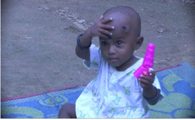 #EveryChildAlive campaign : पश्चिम सिंहभूम की फूलमती हाईबुरू को मिला नया जीवन