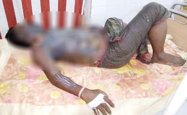 मुंगेर : जमीन विवाद में अधेड़ के शरीर पर पेट्रोल छिड़क कर जिंदा जलाया, गंभीर हालत में पटना रेफर