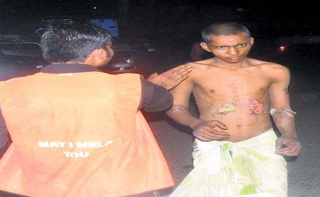 मानसिक रूप से बीमार व जख्मी युवक को रिम्स के गार्ड ने धक्का देकर बाहर निकाला