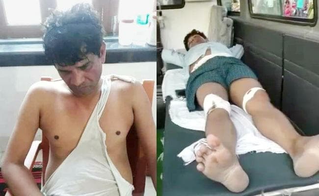 FB पर वाजपेयी की आलोचना किये जाने के बाद प्रोफेसर की जमकर पिटाई, जिंदा जलाने की हुई कोशिश : प्रोफेसर, देखें वीडियाे