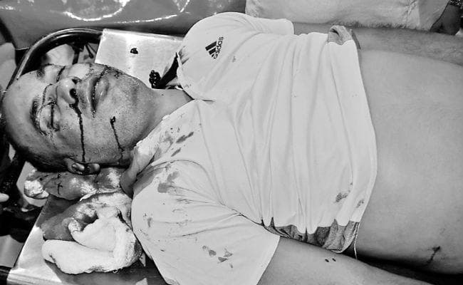 सीतामढ़ी कोर्ट परिसर में कुख्यात संतोष झा की गोली मार कर हत्या, दो अपराधियों ने वारदात को दिया अंजाम