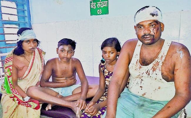 सारण : बकाया पैसा मांगने पर फेंका तेजाब, पिता-पुत्र व पत्नी समेत सात लोग घायल