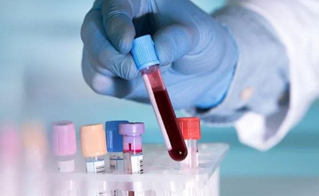 पटना : 6 से 13 सितंबर तक बंद रहेंगे पैथोलॉजी लैब