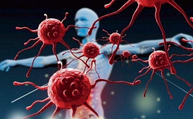 पूरे शरीर को प्रभावित करता है ऑटोइम्यून डिसऑर्डर