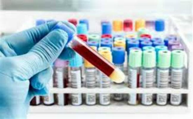 लैब टेक्नीशियनों की हड़ताल खत्म पीएमसीएच में 40% मरीजों की जांच